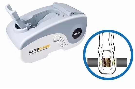 科进 OSTEO KJ3000 超声骨密度仪