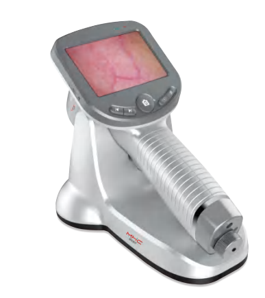 创弘手持式电子皮肤镜CH-DS50