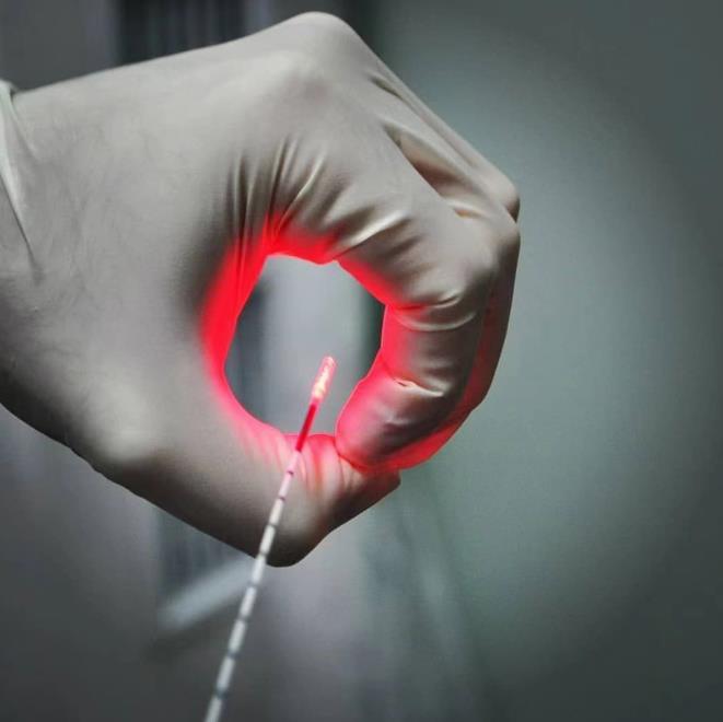 优福通一次性使用激光光纤EFLM-ME-06-S