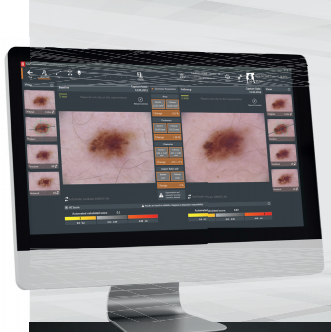 德国FotoFinder数字皮肤镜FotoFinder bodystudio ATBM