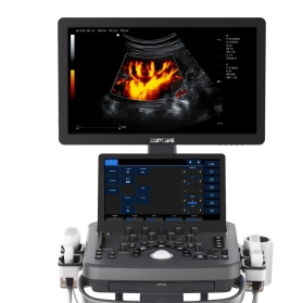 武汉中旗彩色多普勒超声系统ViV40