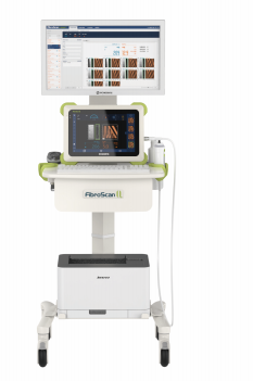 回波肝功能剪切波是化超声诊断仪Fibroscan Q-ST