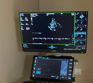 通用超声影像数据管理软件ViewPoint 6