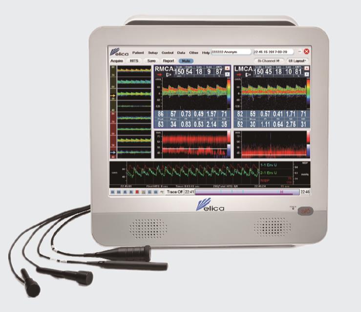 德力凯 超声经颅多普勒血流分析仪 EMS-9D