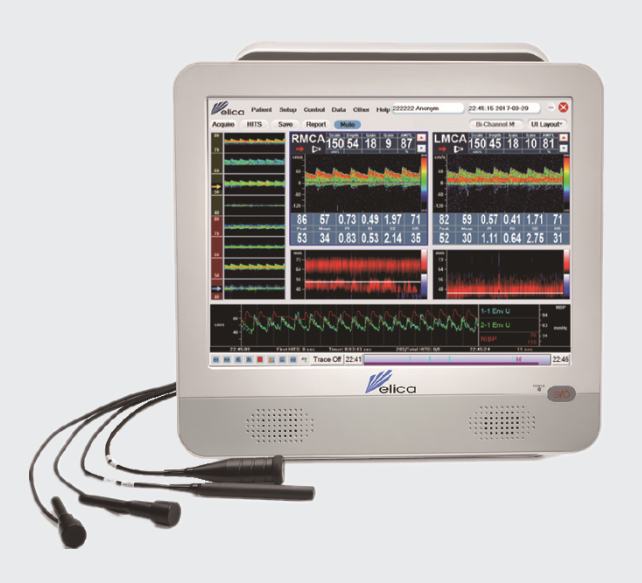 德力凯超声经颅多普勒血流分析仪EMS-9J