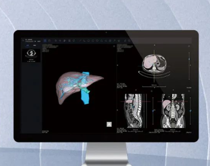 CT图像处理软件IntelliSpace Portal – CT