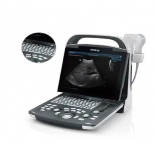 便携式高端彩色多普勒超声诊断仪m11