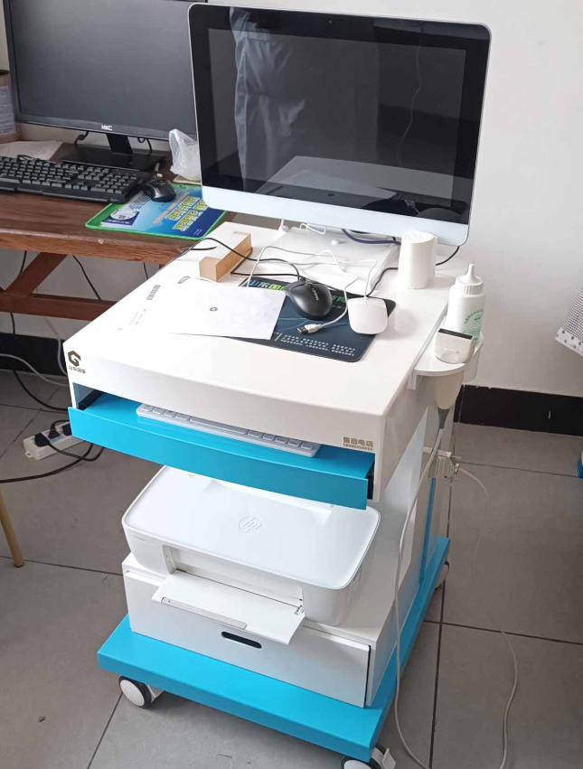 UBS-3000mini 超声骨密度检测仪价格区间