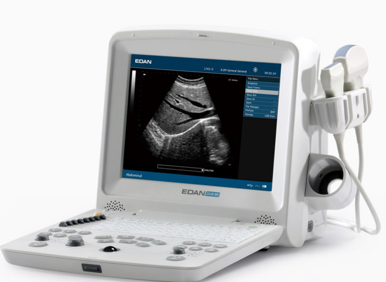 全数字超声诊断系统